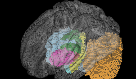 image TranslucentBrain.png 