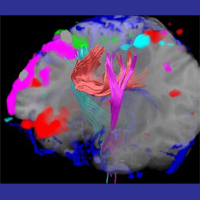 DTI + fMRI Viz 