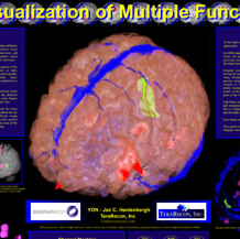 fMRI Viz 