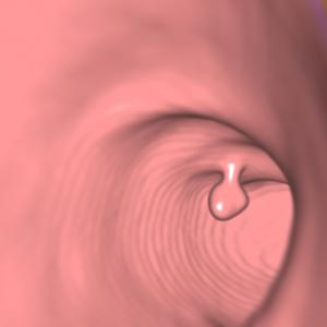 image colon.jpg 